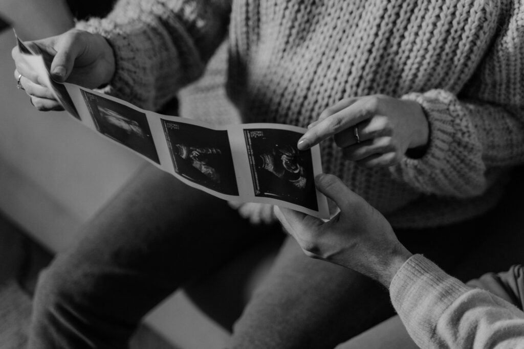Black and white photo of hands holding ultrasound images, symbolizing pregnancy journey.